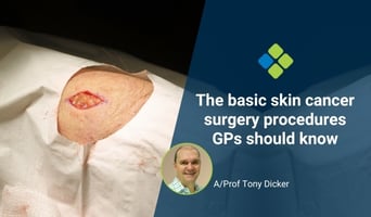 GP skin cancer surgery procedures