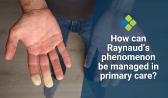 Raynaud’s phenomenon