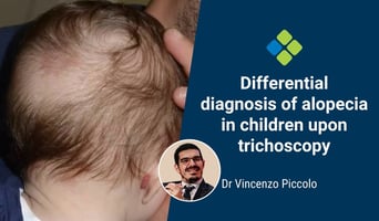 trichoscopy diagnosis alopecia in children