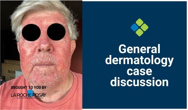 general dermatology case discussion