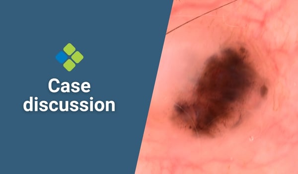 case discussion