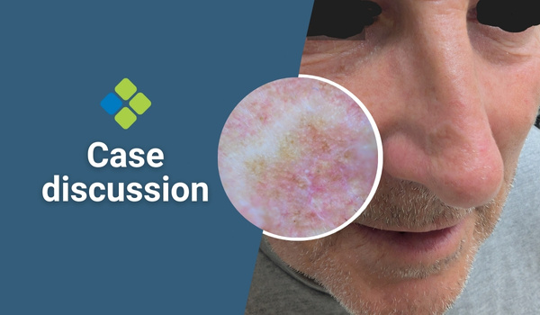 case discussion